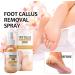 Tongyend Foot Peeling Spray Instant Foot Peeling Spray Foot Callus Removal Spray Moisturizing Hydrating Nourish Peel off Spray Foot Exfoliating Spray Remove Foot Dead Skin-30ML FootCallusRemover - Buy Online on GoSupps.com