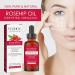 Cold-Pressed Rosehip Oil for Face | Nourishing Moisturizer for All Skin Types | 30ml Essential Oil for Skin Hair & Nails - Buy Online on GoSupps.com