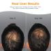 Viviscal Men's Hair Growth Supplements - 60 Tablets for Thicker Hair - Clinically Proven with Collagen Complex - 1 Month Supply - Buy Online on GoSupps.com