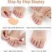 4 Pcs Soft Metatarsal Foot Cushions - Breathable Silicone Gel Pads for Neuroma & Callus Relief - Hypoallergenic & Reusable Spacers (Flesh & White - Buy Online on GoSupps.com