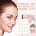 Scettar 272 Invisible Pimple Patches | Hydrocolloid Acne Treatment | Anti-Inflammatory Solution for Clear Skin - Buy Online on GoSupps.com