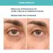Buy FOREO IRIS Eye Cream - Brightening Dark Circles & Puffiness - Vegan Travel Size 0.5 oz - All Skin Types - Buy Online on GoSupps.com