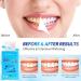Waving Palms Teeth Whitening Strips - 28 Professional Blue Teeth Whitening Strips for a Bright Smile | Fast International Shipping - Buy Online on GoSupps.com