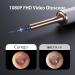 Professional Ear Wax Removal Tool - Safe & Effective | Buy Online - Buy Online on GoSupps.com