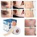 LOKFAM Silicone Scar Tape - Advanced Reusable Treatment for Surgical Scars, Tummy Tuck, Keloids & Injuries - 1.6*12 Roll - Buy Online on GoSupps.com