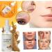 Turmeric Dark Spot Corrector Serum - Brighten, Hydrate, and Repair Dull & Dry Skin (2x30ml) - Buy Online on GoSupps.com