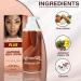 Lightenup Plus Skin-Light Body Lotion 13.5 fl oz - Fade Dark Spots Elbow & Armpit Treatment with Shea Butter & Alpha-Arbutin - Buy Online on GoSupps.com