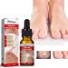 Ingrown Toenail Treatment Nail Helper Nail Growth Treatment Ingrown Toenail Drops Cuticle Nail Oil Ingrown Toenail Correction Fungal Nail Treatment for Toenails Extra Strong for Damaged Nails