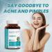 Biovitalia Neem 1000mg Capsules for Healthy Skin & Detox - 60 Vegan Capsules - Buy Online on GoSupps.com