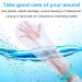 Waterproof Arm Cast Cover - Reusable Protector for Adult & Child - Shower Dressing for Broken Hand, Elbow, Wrists - ACHANFLY - Buy Online on GoSupps.com