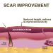 Epi-Derm Large Silicone Scar Sheet - 11 x 15.75 in - Natural - Biodermis - Buy Online on GoSupps.com