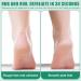 Electric keratinized epidermal removal device electric removal of keratinized epidermis rechargable foot care kit keratinized epidermis 2 - Buy Online on GoSupps.com