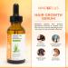 Mino Plus Natural Hair Growth Serum - 60ml / 2fl oz For Longer Stronger Thicker Fuller Hair - Formulated to Prevent Hair Loss Hair Fall with Aloe Vera - Buy Online on GoSupps.com