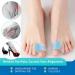 Gel Toe Separators for Overlapping Toes | Bunion Relief & Hallux Valgus Corrector for Men & Women - Orthopedic Toe Spacers - Blue - Buy Online on GoSupps.com