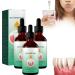 Dentizen Gum Regrowth Drops Gum Restoration Dentizs Drops Gum Disease Treatment Gum Regrowth Treatment Drops Rejuvenate Your Gums With Ease Natural Mouthwash for Oral Care (3 PCs)