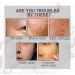 Buy Anti Wrinkle Peptide Serum - Anti Aging Face Tightening Cream for Fine Lines & Wrinkles | Hydrating Peptide Formula for Youthful Skin - Buy Online on GoSupps.com