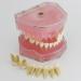 Dental Implant Teeth Model - Standard Study and Teaching Tool with Removable Teeth - Buy Online on GoSupps.com