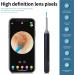 1080 HD Wireless Ear Wax Removal Camera Kit - Ear Wax Remover Tool with LED Lights for iPhone iPad & Android - Buy Online on GoSupps.com
