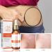 Stretch Mark Repair Essential Oil - 2/3/4PCS Pregnancy & Postpartum Scar Treatment | Prevent & Remove Stretch Marks - Buy Online on GoSupps.com
