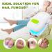Nail Fungus Cleaning Light Device - Effective Treatment for Discolored Thickened Toenails at Home - Nail Fungus Remover (White - Buy Online on GoSupps.com