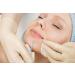 K-Pro Comedone Extractor - Blackhead & Blemish Remover (White) - Buy Online on GoSupps.com