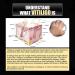 Vitiligo Fix Revitalize Elixir Cream | Psoriasis Relief | Moisturizer for Skin | Reduce White Spots | 3pcs Set - Buy Online on GoSupps.com
