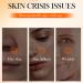 S rums la Vitamine C pour le Visage+Cr me Hydratante Vitamine C Anti- ge Anti-Rides Anti-Taches Hydratant claircissant Serum hydratant anti- ge & anti ride pour le Visage - Buy Online on GoSupps.com
