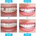Skhaovs 100-Piece Temporary Tooth Crown Denture Set - Provisional Dental Repair for Front & Molar Teeth - Buy Online on GoSupps.com