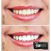 MagicBrite Teeth Whitening Strips | Bamboo Activated Charcoal for Instant Whitening & No Mess - Buy Online on GoSupps.com