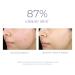 Blemish Control Serum: Target Acne with Powerful Treatment Formula - Buy Online on GoSupps.com