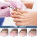 Ingrown Toenail Corrector Patch 300PCs Ingrown Toenail Corrector Strips Toenail Correction Patches Ingrown Toenail Treatment Tool Foot Care No-Glue Painless Toenail Correction Stickers - Buy Online on GoSupps.com