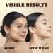 ISTON Vitamin C Face Serum - Hydrate & Rejuvenate with Hyaluronic Acid Niacinamide & Peptides - Anti-Aging Even Skin Tone Reduce Dark Spots - 1.69 Fl Oz - Buy Online on GoSupps.com