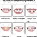 FCcassiel Snap on Veneers - Temporary Teeth Cover for Men and Women - Fix Imperfect Teeth, No Pain or Drilling - Pack of 2 - Buy Online on GoSupps.com