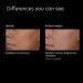 PCA SKIN Intensive Brightening Treatment - Vitamin A Retinol Serum for Dark Spots (1 oz) - Buy Online on GoSupps.com