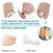 Hammer Toe Wraps - 12 Piece Bandage Cushion & Toe Separator Splints for Crooked, Overlapping, Bent Toes - Men and Women - Buy Online on GoSupps.com