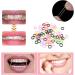 Angzhili 1000 Orthodontic Rubber Bands - Latex-Free Multicolored Elastic Ligaments (0.6 cm) for International Shipping - Buy Online on GoSupps.com