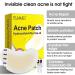 Hydrocolloid Acne Patch - Large Spot Control Stickers for Body Cheek Forehead & Chin | 20 Plasters for Effective Acne Treatment - Buy Online on GoSupps.com