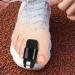 Adjustable Toe Straightener Splints for Toe Injuries - 2Pcs - Buy Online on GoSupps.com