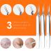 2023 Professional Blackhead & Pimple Popper Tool Kit | 15 PCS Acne Extractor Set with Metal Case - Stainless Steel Blemish Removal Tools - Buy Online on GoSupps.com