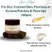 Ultra Healing Cream | 40g Wheatgerm & Castor Oil | Moisturizer for Dry Cracked Skin Psoriasis & Eczema Relief - Buy Online on GoSupps.com