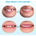 LABER Fake Teeth Cosmetic Denture Veneers - Natural Shade for Confident Smile (2 PCS) - Red - Buy Online on GoSupps.com