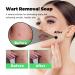 Smoothskin Wart Eliminator Soap - 3 Piece Set with Aloe Vera | For All Skin Types | Women's Natural Soap for Oily and Dry Skin - Buy Online on GoSupps.com