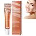 Milk Spots Remover Eye Cream Milia Remover Eye Cream Milia Spot Treatment Eye Cream Milk Spots Removal Eye Cream Smooth Milia Eyes Cream Milia Spot Treatment Eye Cream