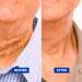 Men's Particle Neck Firming Cream - Anti Aging Triple Action with Collagen, Hyaluronic Acid & Retinol | Lift, Moisturize and Tighten Saggy Skin | 50 ml - Buy Online on GoSupps.com