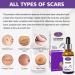 AICHUN BEAUTY Lavender Extract Scar Repair Essence | Anti-Scar Essential Oil for Smooth Skin | 30ml - Buy Online on GoSupps.com