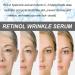 Japan Retinol Serum - 0.4% Retinol & Hyaluronic Acid | Anti-Aging Face Serum for Women & Men | Reduce Fine Lines & Wrinkles - Buy Online on GoSupps.com