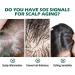 GFOUK Scalp Folliculitis Therapy Oil Folliculitis Scalp Oil Nourishing Treatment for Hair Scalp Therapy Oil Nourishing Treatment for Split Ends and Dry Scalp for All Hair Types (3PC) - Buy Online on GoSupps.com