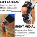 Comfyorthopedic OA Unloader Knee Brace - Left Medial Arthritis Relief for Bone on Bone Joint Pain - L1851/L1843 - Buy Online on GoSupps.com