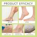 Baume apaisant et cicatrisant pour les jambes baume pour jambes enfl es baume miracle pour les veines r duit les gonflements soulage l'inconfort am liore les varices 2 Pi ces. - Buy Online on GoSupps.com