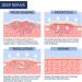 Silicone Scar Tape for Surgical Scars - Extra Long Scar Sheets for C-Section (59 in x 1.5 in) - Buy Online on GoSupps.com